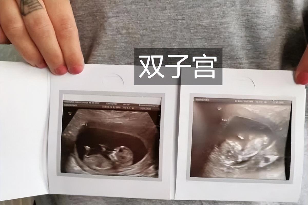 春秋动物有特出，三四八取其尾数打一准确生肖，详细解答、专家解答解释落实